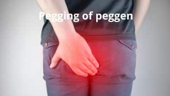 zere anus peggen